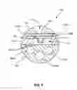 Fig. 09 - Implantable micro-electromechanical system sensor