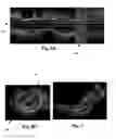 Fig. 07 - Systems and methods for detecting and displaying body lumen bifurcations