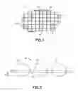 Fig. 02 - Clay-based hemostatic agents and devices for the delivery thereof