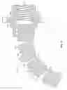 Fig. 09 - Dispensing fluid from an infusion pump system