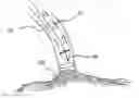 Fig. 01 - Devices, systems, and methods for myocardial infarct border zone reinforcement