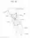 Fig. 09 - Devices, systems, and methods for myocardial infarct border zone reinforcement