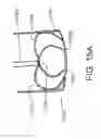 Fig. 22 - Devices, systems, and methods for myocardial infarct border zone reinforcement