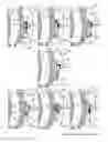 Fig. 22 - Method and apparatus for transforming a delivery container into a waste disposal system