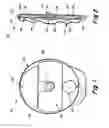 Fig. 02 - Medication infusion device using negatively biased ambient pressure medication chamber
