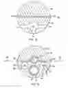 Fig. 13 - Epicardial mapping and ablation catheter