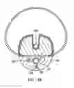 Fig. 25 - Epicardial mapping and ablation catheter