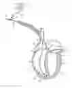 Fig. 01 - MULTI-FUNCTION LEAD IMPLANT TOOL