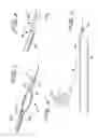 Fig. 02 - Cutting wire assembly for use with a catheter