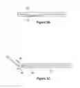 Fig. 04 - Direction reversing vascular treatment device