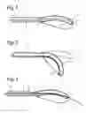 Fig. 02 - Surgical cutting instrument