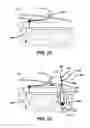 Fig. 08 - Surgical filament snare assemblies