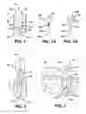 Fig. 02 - Surgical filament snare assemblies