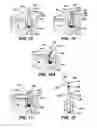 Fig. 06 - Surgical filament snare assemblies