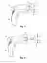 Fig. 02 - Electromechanical adjusting instrument