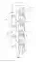 Fig. 02 - Orthosis to Correct Spinal Deformities