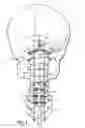 Fig. 02 - Adjustable occipital plate