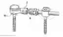 Fig. 01 - Extra-discal intervertebral stabilization device
