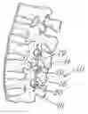 Fig. 01 - Capless multiaxial screw and spinal fixation assembly and method