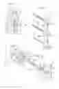 Fig. 02 - Capless multiaxial screw and spinal fixation assembly and method