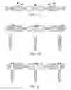 Fig. 04 - Methods and Apparatus for Treating Spinal Stenosis
