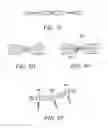 Fig. 06 - Methods and Apparatus for Treating Spinal Stenosis