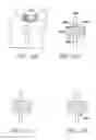 Fig. 16 - Methods and Apparatus for Treating Spinal Stenosis