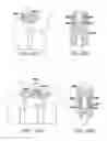 Fig. 48 - Methods and Apparatus for Treating Spinal Stenosis