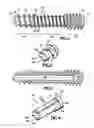 Fig. 02 - AXIAL TENSION SCREW