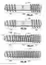 Fig. 05 - AXIAL TENSION SCREW