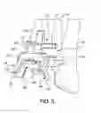 Fig. 06 - Orthopedic surgical guide