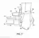 Fig. 08 - Orthopedic surgical guide