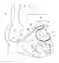 Fig. 01 - Pacing lead for a left cavity of the heart, implanted in the coronary system