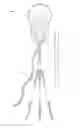 Fig. 01 - Vestibular stimulation device
