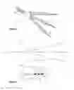 Fig. 03 - Vestibular stimulation device