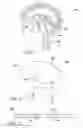 Fig. 02 - INTERFACIAL STENT AND METHOD OF MAINTAINING PATENCY OF SURGICAL FENESTRATIONS