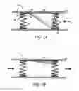 Fig. 04 - METHODS AND APPARATUS FOR TREATING NEUROVASCULAR VENOUS OUTFLOW OBSTRUCTION