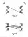 Fig. 06 - METHODS AND APPARATUS FOR TREATING NEUROVASCULAR VENOUS OUTFLOW OBSTRUCTION