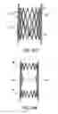 Fig. 10 - METHODS AND APPARATUS FOR TREATING NEUROVASCULAR VENOUS OUTFLOW OBSTRUCTION