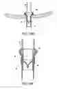 Fig. 12 - METHODS AND APPARATUS FOR TREATING NEUROVASCULAR VENOUS OUTFLOW OBSTRUCTION