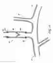Fig. 16 - METHODS AND APPARATUS FOR TREATING NEUROVASCULAR VENOUS OUTFLOW OBSTRUCTION
