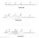 Fig. 19 - METHODS AND APPARATUS FOR TREATING NEUROVASCULAR VENOUS OUTFLOW OBSTRUCTION