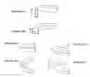 Fig. 24 - METHODS AND APPARATUS FOR TREATING NEUROVASCULAR VENOUS OUTFLOW OBSTRUCTION