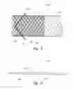 Fig. 04 - Stent graft delivery systems and associated methods