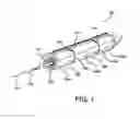 Fig. 02 - SLEEVES FOR EXPANDABLE MEDICAL DEVICES