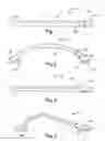 Fig. 02 - VASCULAR PROSTHESIS AND RELEVANT METHOD FOR REALISING THEREOF
