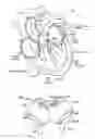 Fig. 02 - Artificial heart