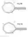 Fig. 08 - METHODS AND APPARATUS FOR IN SITU FORMATION OF SURGICAL IMPLANTS