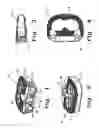 Fig. 02 - Intervertebral fusion implant