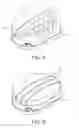 Fig. 06 - Modular glenoid prosthesis